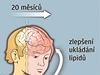 HIV opravářem | na serveru Lidovky.cz | aktuální zprávy HIV opravářem | na serveru Lidovky.cz | aktuální zprávy
