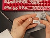 TIME OUT LN: Doping. Sport bojuje s větrnými mlýny | Lidovky.cz - Názory Dopingová laboratoř.