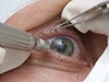 Vy�et�en� o�� - ilustra�n� foto.