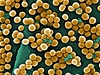 Zlatý stafylokok (Staphylococcus aureus) | na serveru Lidovky.cz | aktuální zprávy Zlatý stafylokok (Staphylococcus aureus) | na serveru Lidovky.cz | aktuální zprávy